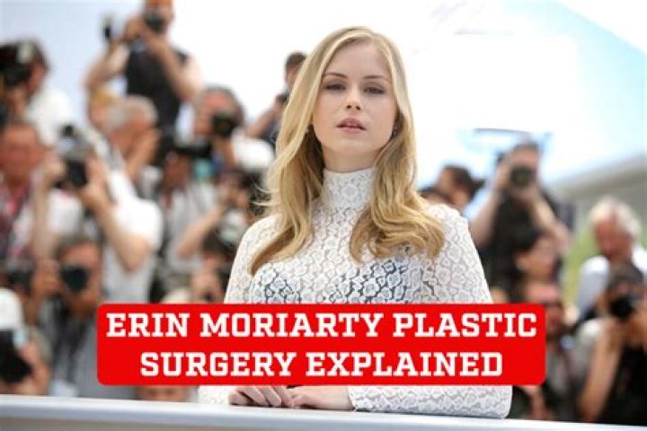 Erin Moriarty Net Worth 2024, Age, Height, Bio, Birthday, Wiki!